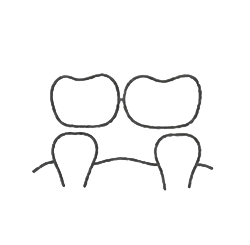 Symbol für Zahnbrücke