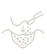 Icon Auflagerungsplastik