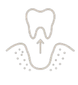 Icon Socketpreservation